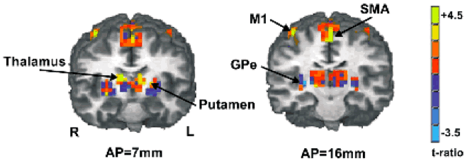 fMRI excitation